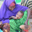 旱灾导致患严重急性营养不良的索马里儿童大幅增加 - 人民网